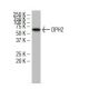 DPH2 Antibody (6E7) - Western Blotting - Image 34560 