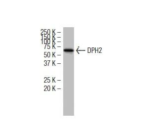 DPH2 Antibody (6E7) - Western Blotting - Image 34560Each CRISPR/Cas9 Knockout (KO) Plasmid product consists of a pool of 3 plasmids designed to ensure identification and cleavage of a specific gene for maximum knockout efficiency. Each plasmid encodes a unique 20 nt sequence derived from the GeCKO (v2) library.