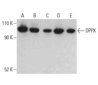 DPPX Antibody (A-8) - Western Blotting - Image 399126 