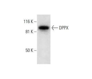 DPPX Antibody (E-5) - Western Blotting - Image 295867 