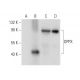 DPPX Antibody (H-4) - Western Blotting - Image 308164