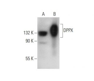 DPPX Antibody (H-4) - Western Blotting - Image 309536 