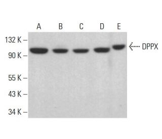 DPPX Antibody (A-8) - Western Blotting - Image 382608 