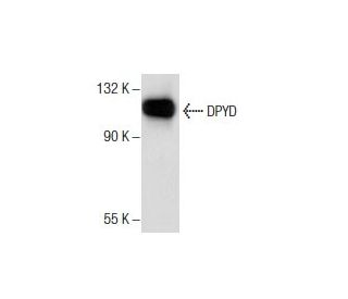 DPYD Antibody (F-8) - Western Blotting - Image 157824 