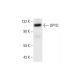 DPYD Antibody (F-8) - Western Blotting - Image 292904 