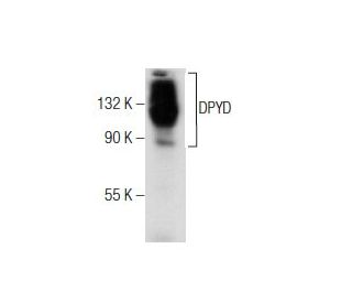 western blotting image from recommended DPYD (A-5) monoclonal antibody replacement. Image 158366