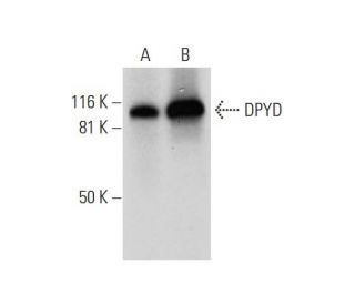 DPYD Antibody (D-8) - Western Blotting - Image 296139 