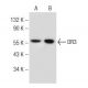 western blotting image from recommended DR3 (B-8) monoclonal antibody replacement. Image 149008