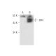 DR4 Antibody (B-N28) - Western Blotting - Image 56232