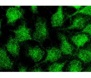 immunofluorescence image from recommended DR5 (D-6) monoclonal antibody replacement. Image 145442