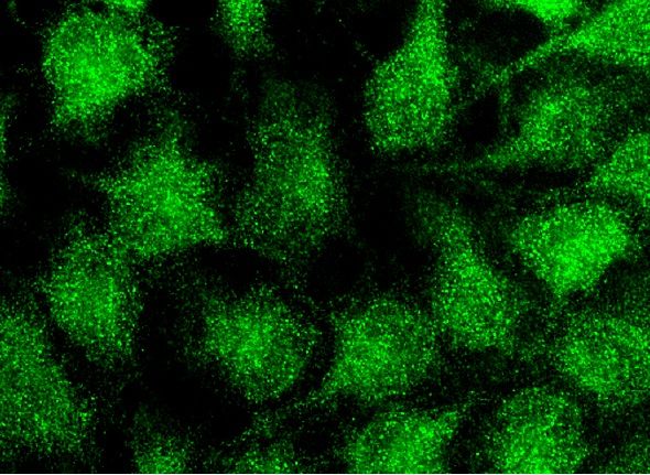 youページ DR5 Antibody (D-6) | SCBT - Santa Cruz Biotechnology