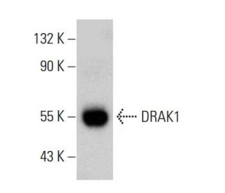 DRAK1 Antibody (3064C6a) - Western Blotting - Image 385140SAM Transcription Activation: SAM system utilizing dCas9-VP64, MS2-P65-HSF1, and sgRNA for precise gene transcription activation.