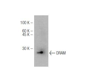 DRAM Antibody (M3-P4B4) - Western Blotting - Image 47828 