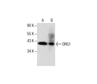 DRG1 Antibody (E-2) - Western Blotting - Image 285783 