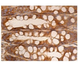 DRP1抗体(C-5) | SCBT - Santa Cruz Biotechnology