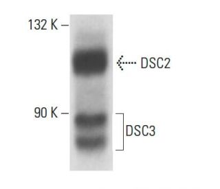 DSC2/3 Antibody (3G130) - Western Blotting - Image 18121 
