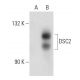 DSC2/3 Antibody (3G130) - Western Blotting - Image 51978