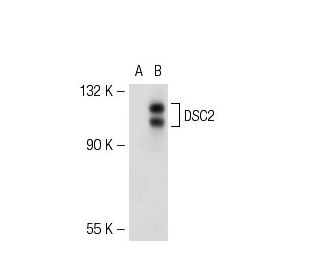 DSC2/3 Antibody (7G6) - Western Blotting - Image 51980