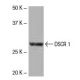 DSCR 1 Antibody (34-A) - Western Blotting - Image 53858