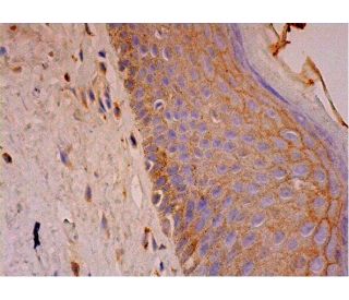 dsg1 Antibody (27B2) - Immunohistochemistry - Image 293447 
