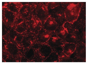 dsg1 Antibody (B-11) | SCBT - Santa Cruz Biotechnology