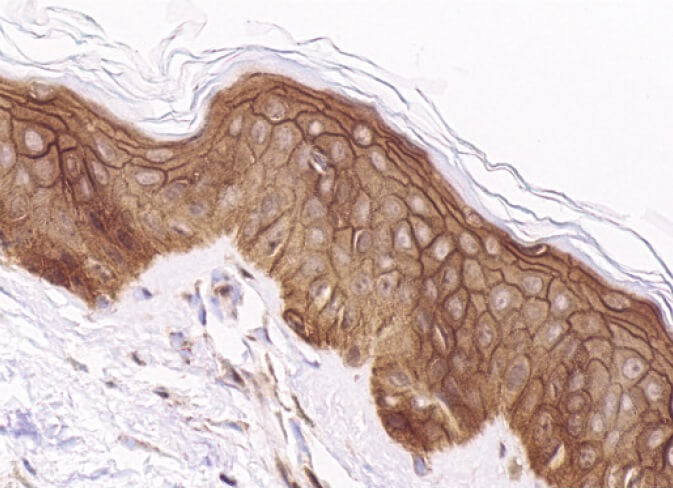 Helページ dsg1 Antibody (B-11) | SCBT - Santa Cruz Biotechnology