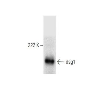 dsg1-antibody-b-11-western-