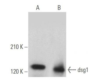 dsg1 Antibody (B-11) - Western Blotting - Image 360136 