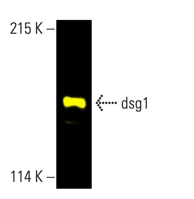 dsg1 Antibody (B-11) | SCBT - Santa Cruz Biotechnology