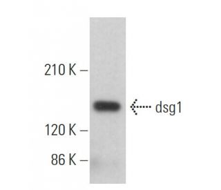 western blotting image from recommended dsg1 (B-11) monoclonal antibody replacement. Image 359367
