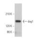 western blotting image from recommended dsg1 (B-11) monoclonal antibody replacement. Image 359367