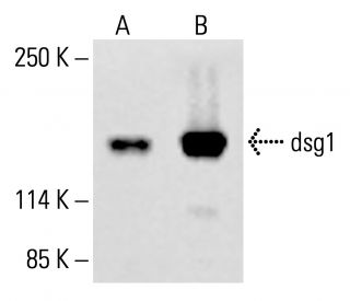dsg1 Antibody (B-11) - Western Blotting - Image 413518