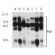 dsg2 Antibody (6D8) - Western Blotting - Image 12579 