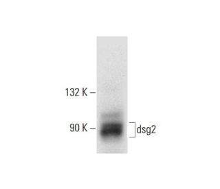 dsg2 Antibody (F-5) - Western Blotting - Image 297586 