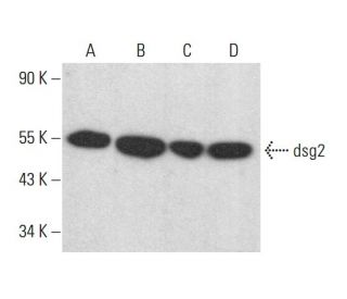 dsg2 Antibody (F-8) - Western Blotting - Image 383105 
