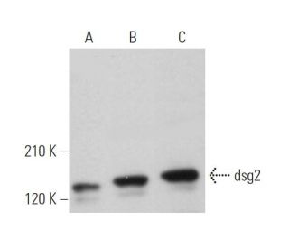 western blotting image from recommended dsg2 (AH12.2) monoclonal antibody replacement. Image 373485