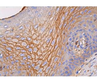 dsg3 Antibody (5G11) - Immunohistochemistry - Image 384183 
