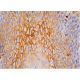 dsg3 Antibody (5G11) - Immunohistochemistry - Image 384182