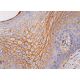 dsg3 Antibody (5G11) - Immunohistochemistry - Image 384183 