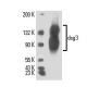 This polyclonal antibody has been discontinued. See our recommended <a href="dsg3-antibody-5h10">dsg3 (5H10)</a> monoclonal antibody (sample data shown). western blotting image from recommended dsg3 (5H10) monoclonal antibody replacement. Image 16161