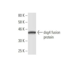 dsg4 Antibody (6E7) - Western Blotting - Image 350340 