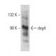 dsg4 Antibody (6E7) - Western Blotting - Image 384452 