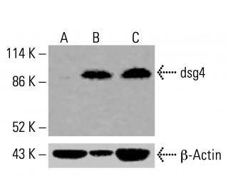 dsg4 Antibody (6E7) - Western Blotting - Image 416133 