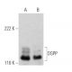 This polyclonal antibody has been discontinued. See our recommended <a href="dspp-antibody-lfmb-21">DSPP (LFMb-21)</a> monoclonal antibody (sample data shown). western blotting image from recommended DSPP (LFMb-21) monoclonal antibody replacement. Image 370517