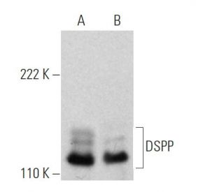 DSPP Antibody (LFMb-21) - Western Blotting - Image 370517The Double Nickase Plasmid features a U6 promoter for sgRNA expression, a 20 nt targeting sequence, and a gRNA scaffold to guide Cas9n. It includes a CBh promoter for Cas9n (D10A) and puromycin resistance, GFP for transfection verification, and nuclear localization signals (NLS). The 2A peptide allows co-expression of Cas9n and Puro from a single promoter, enabling precise genome editing with reduced off-target effects.