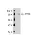 DTX3L Antibody (45.Y) - Western Blotting - Image 32645