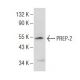 PREP-2 (Q-20): sc-55890. Western blot analysis of PREP-2 expression in DU 145 nuclear extract.