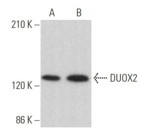 western blotting image from recommended DUOX2 (E-8) monoclonal antibody replacement. Image 368360