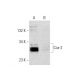 DuP-697: sc-200680. Western blot analysis of Cox-2 expression in untreated (A) and DuP-697 treated (B) A549 whole cell lys