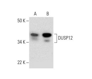 DUSP12 Antibody (H-11) - Western Blotting - Image 289879 